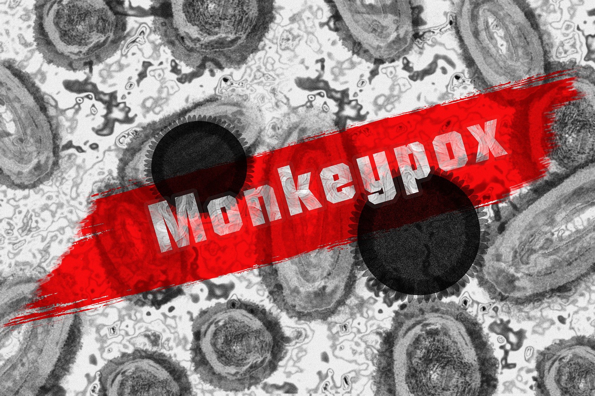 Monkeypox – WHO declares a global emergency