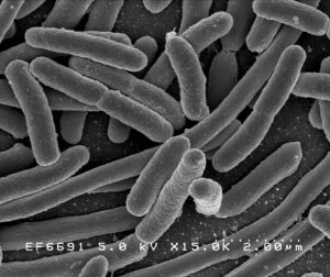 A microscope image of dividing E. Coli bacteria.