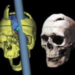 kisiligimiz-beyninimiz-gizemli-kivrimlari-arasinda-bir-yerlerde-mi-phineas-gage